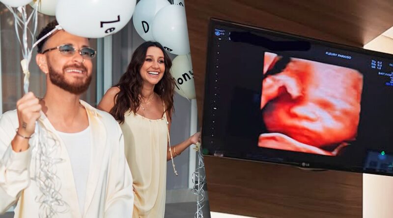 Fred Bruno brinca sobre pé canhoto do filho em ultrassom