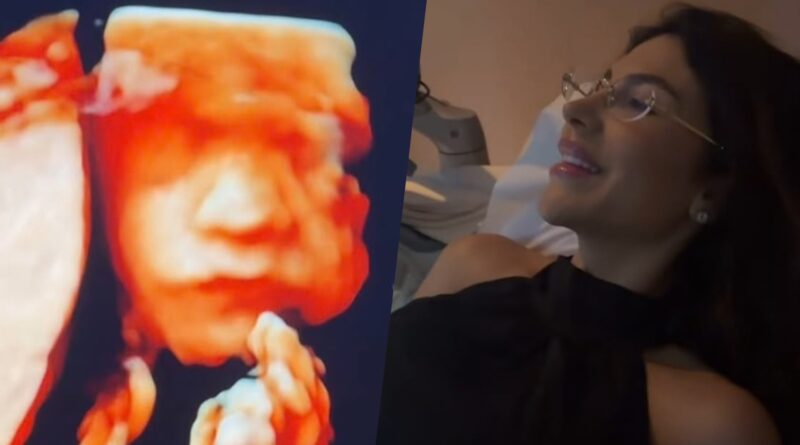 Arthur Aguiar brinca com ultrassom do 3º filho: 'Terceiro filho igual?'